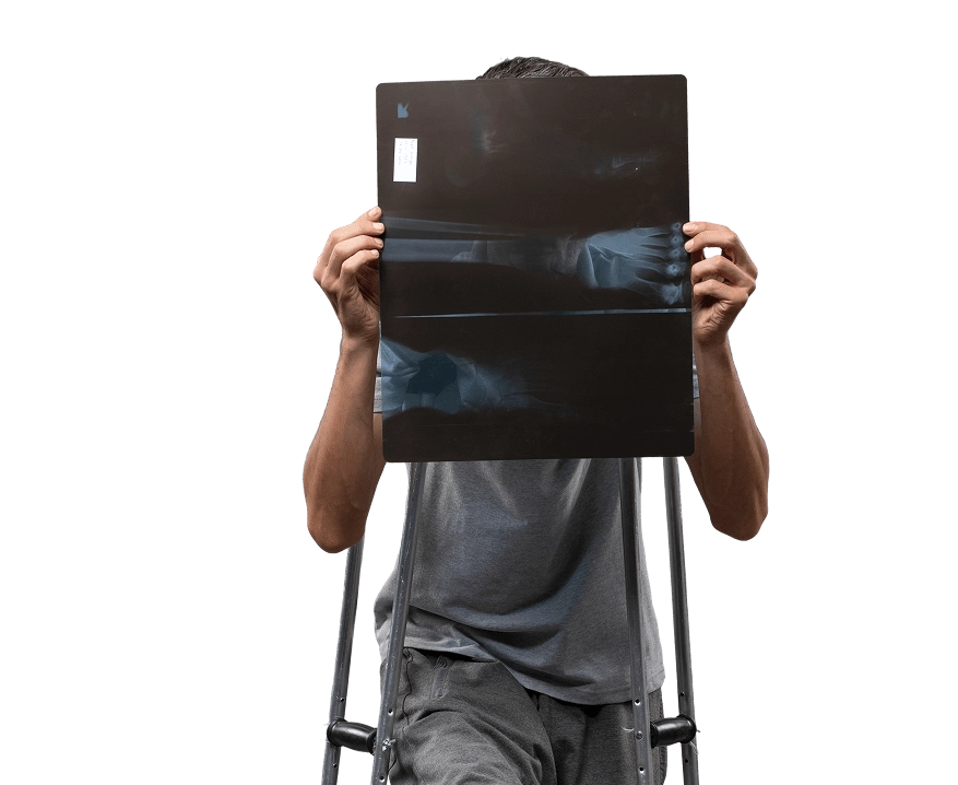 мужчина на костылях изучает рентгеновский снимок